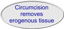 Male infant circumcision removes erogenous tissue from the sex organ