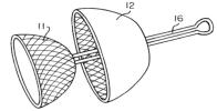 Figure 9B for Dr. Haughey's Tug Ahoy foreskin restoration device patent